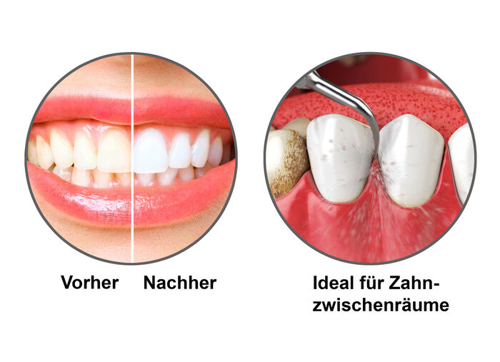 Sonic Tandverzorgingsset 