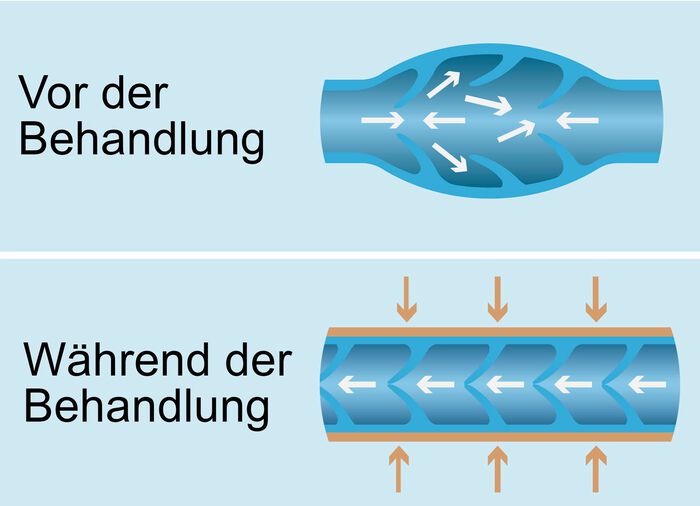 Vitalmaxx aders Walker Pro 2 massagetoestel voor aders 