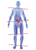 Superthotics Inlegzolen 