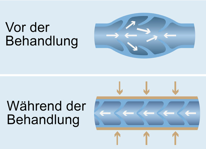 Massagetoestel voor aders 