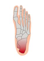 Hielontlastingskussen 