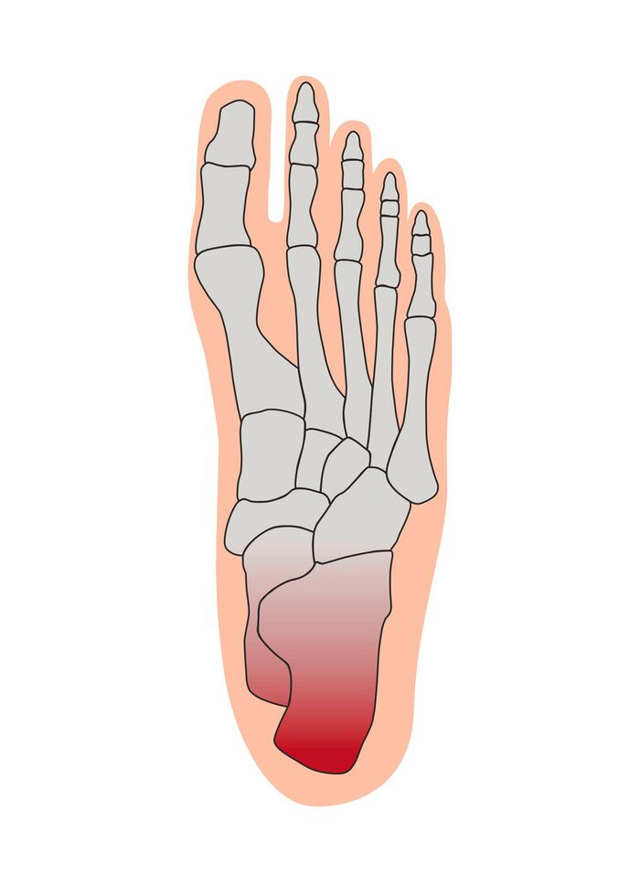Hielontlastingskussen 
