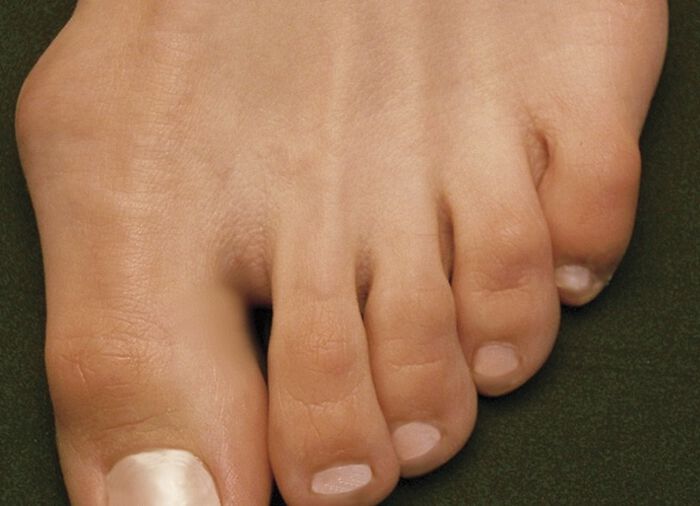 Aerosoft&reg; Flex stretch klittenbandpantoffels van J&uuml;rgen Hirsch&reg; BRUIN