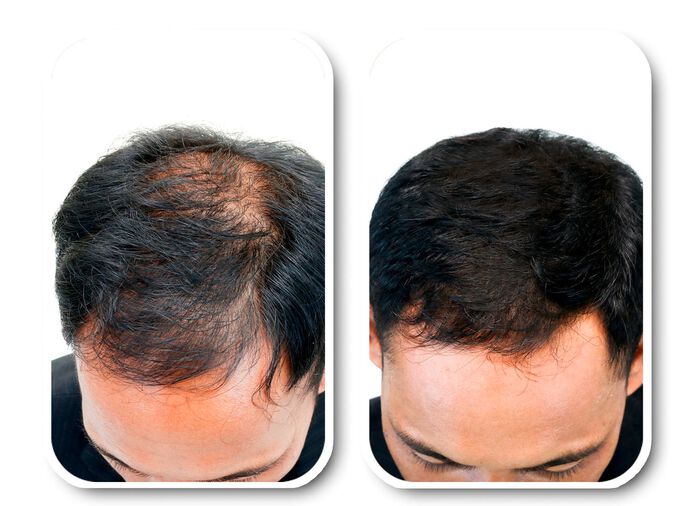 Velform&reg; Voedingslotion voor ieder haartype 