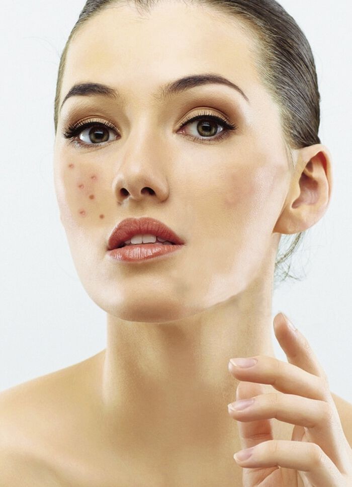 Ikos Dermaprof. Maak het op 