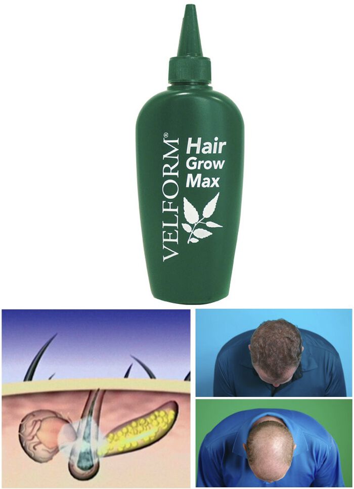 &lsquo;VELFORM Hair Grow Max&lsquo; Haarwater 