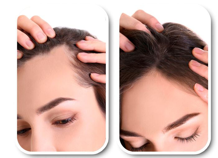 Velform&reg; Voedingslotion voor ieder haartype 