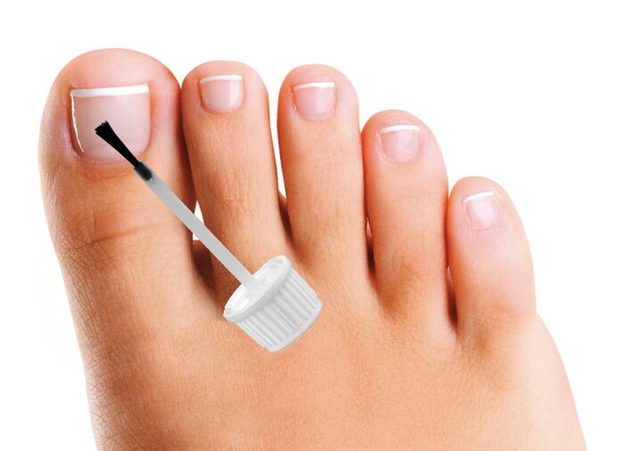 Bausch nagelbehandeling tegen nagelschimmel 