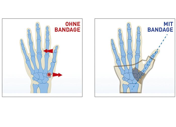 ‘Epitact’ duimbandage 
