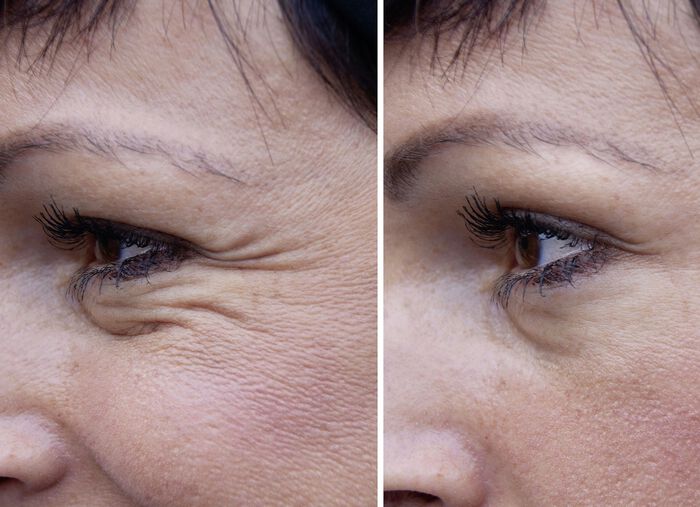 Agefit anti-rimpel serum in verschillende uitvoeringen 